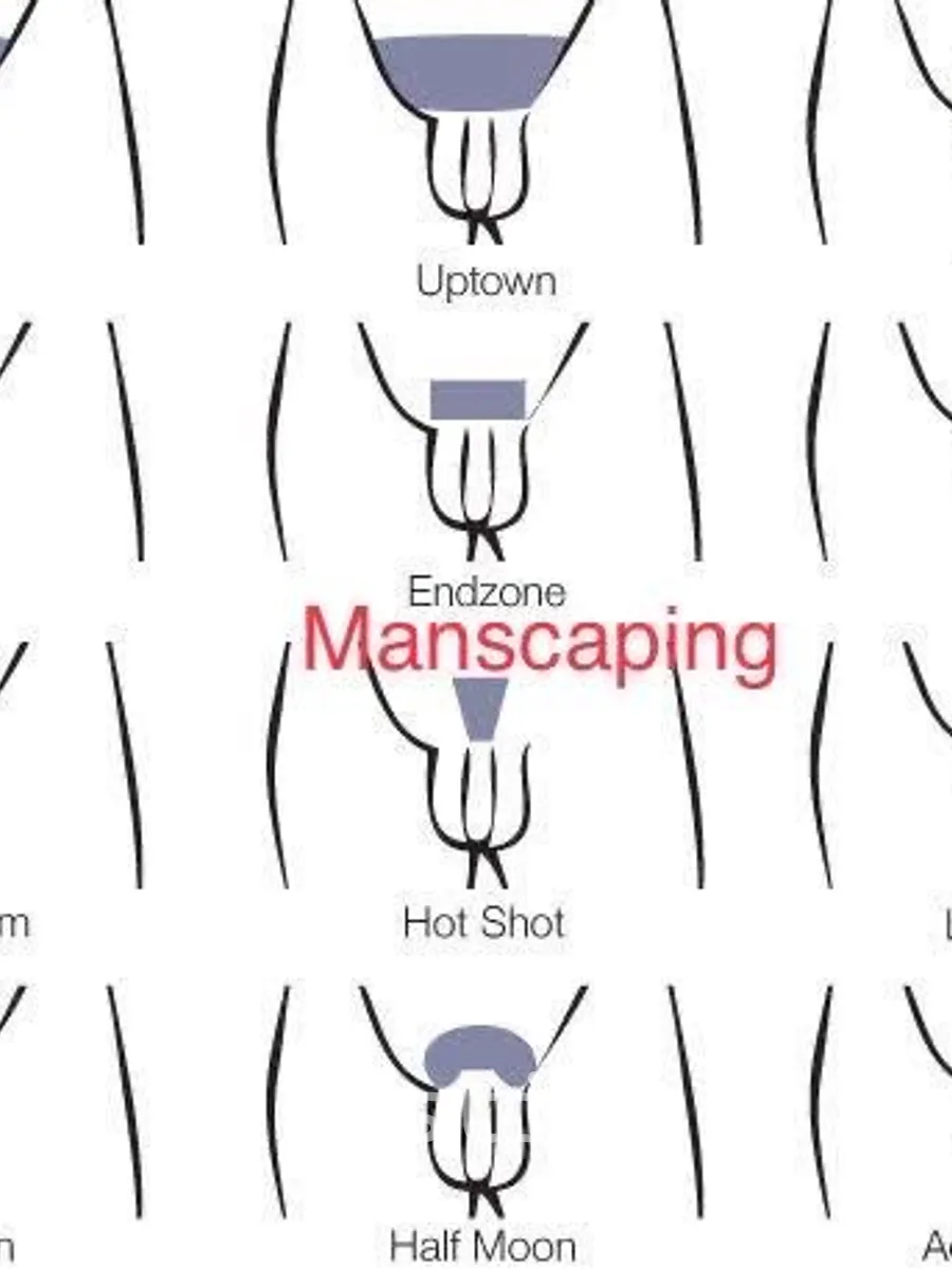 Photo 1 of Laser Hair Removal